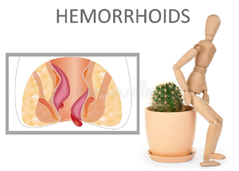 Best Piles Doctor in Sakinaka, Andheri